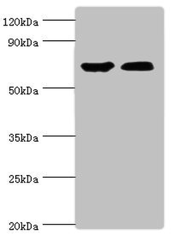 CROT Antibody