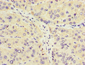 CROT Antibody