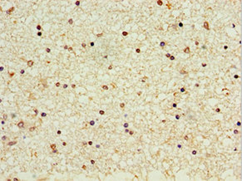 CROT Antibody