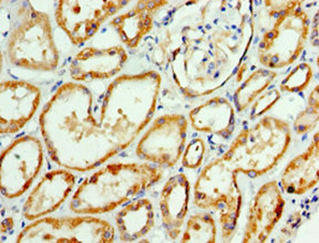 AP1M2 Antibody