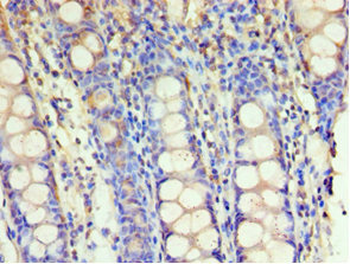GSTM4 Antibody