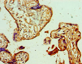 GSTM4 Antibody