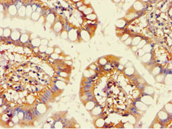 ACAD9 Antibody