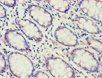 ACAD9 Antibody