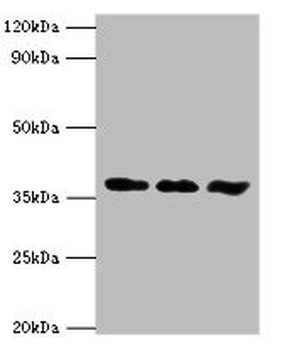 ACVR1 Antibody