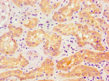 ACVR1 Antibody