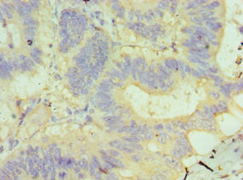 GUSB Antibody