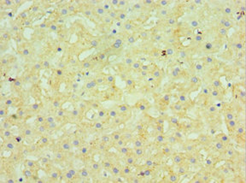 GUSB Antibody