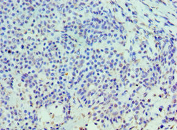 HYAL3 Antibody