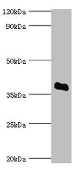 SULT2A1 Antibody