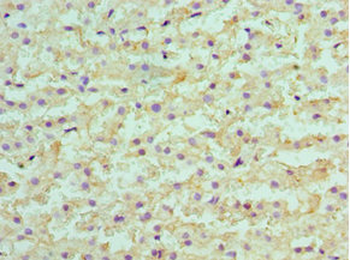 SULT2A1 Antibody