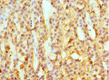 SULT2A1 Antibody