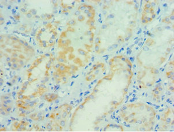PARP3 Antibody