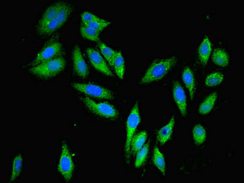 PARP3 Antibody