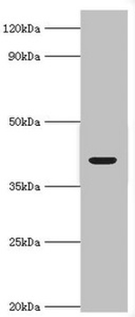 ADH4 Antibody