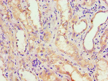 ADH4 Antibody