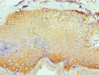 SERPINB1 Antibody