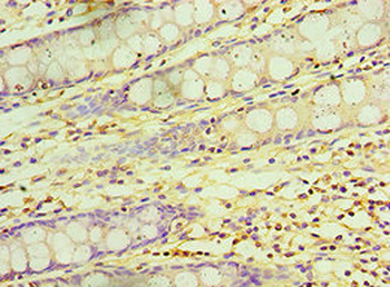 KCTD15 Antibody