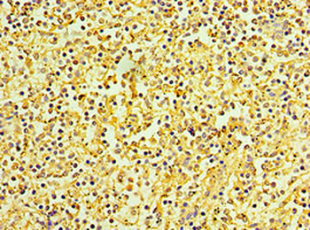 KCTD15 Antibody
