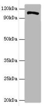 HIP1 Antibody