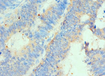 HIP1 Antibody