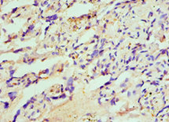 HIP1 Antibody