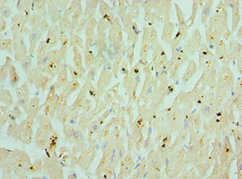 CHRM3 Antibody