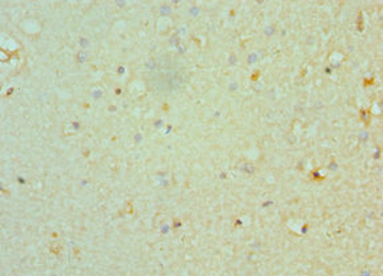 CHRM3 Antibody