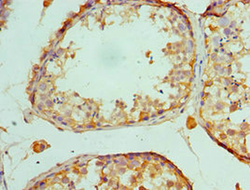 MAP2K5 Antibody