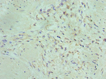 MAP2K5 Antibody