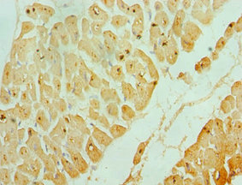 ASAH1 Antibody