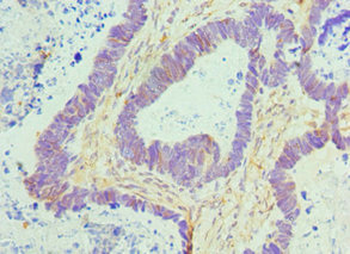 CTCF Antibody