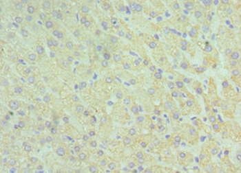 GLUD2 Antibody
