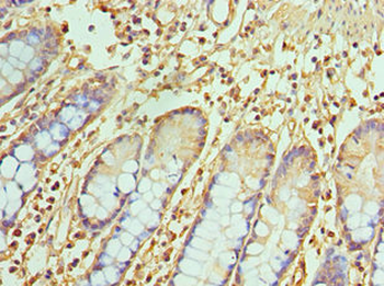 TREX1 Antibody