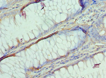 AP2B1 Antibody