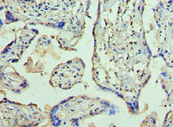 AP2B1 Antibody