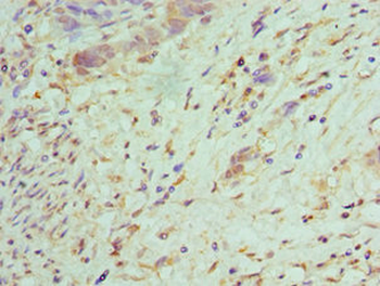 TRADD Antibody