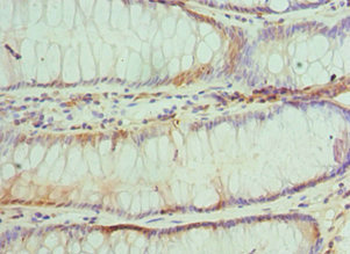 TRADD Antibody