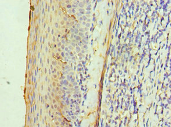 ALAS2 Antibody