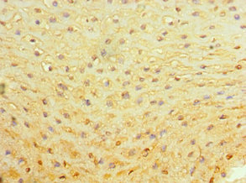 ALAS2 Antibody