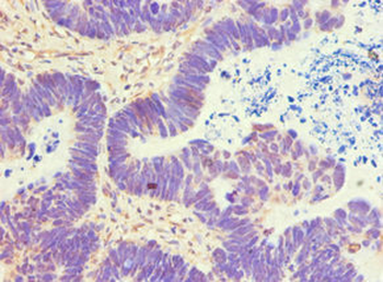 ATP5B Antibody