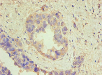 ATP5B Antibody