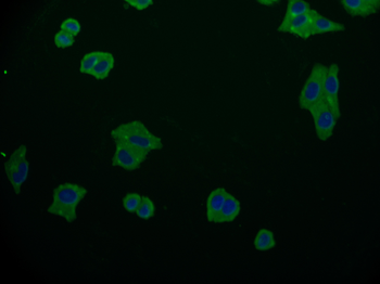 AMHR2 Antibody