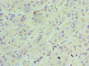 AK2 Antibody