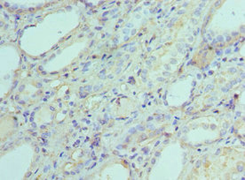 AK2 Antibody