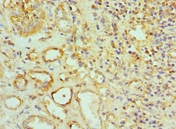 TOMM20 Antibody