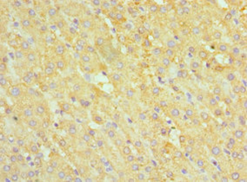 ABAT Antibody