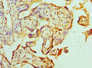 ABAT Antibody