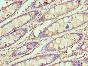 SMARCB1 Antibody