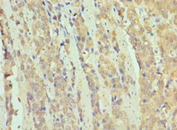 SMARCB1 Antibody